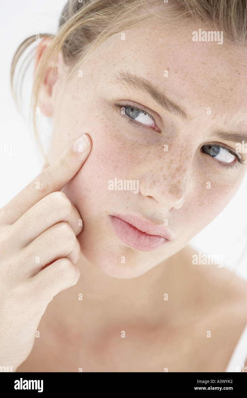 A young woman treating her pimple Stock Photo