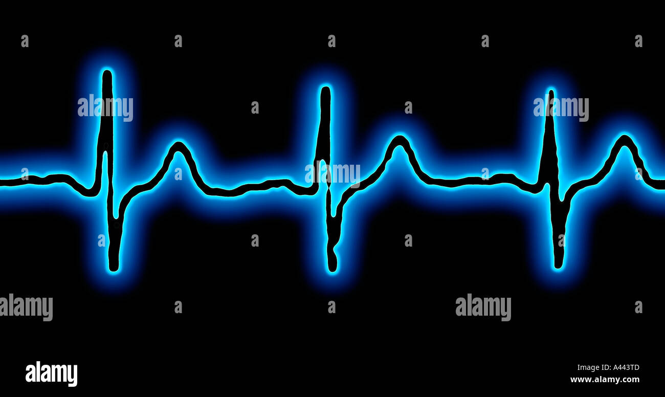 A443td electrocardiogram concept hi-res stock photography and images ...