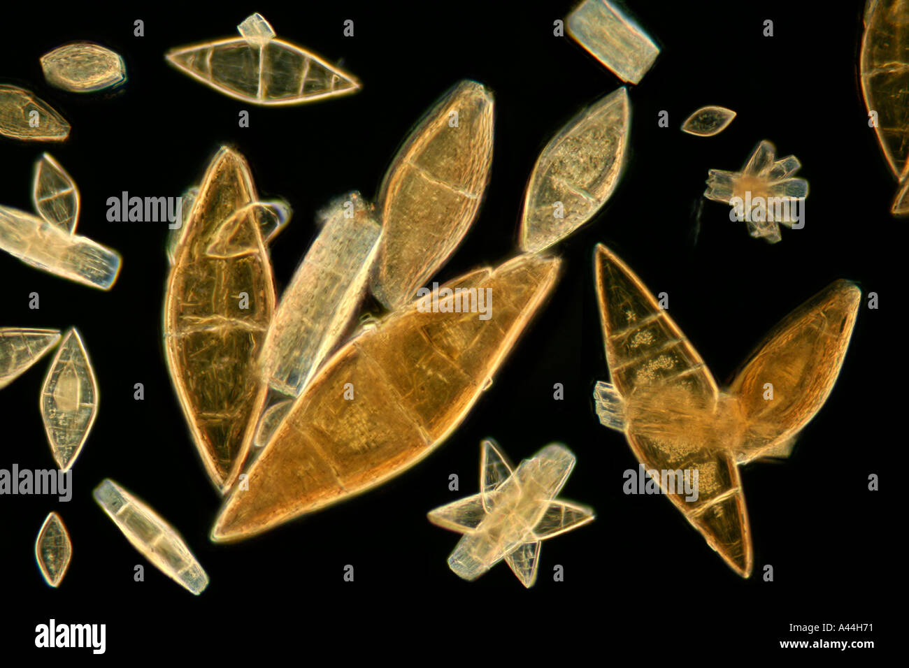 Uric Acid Crystals In Urine