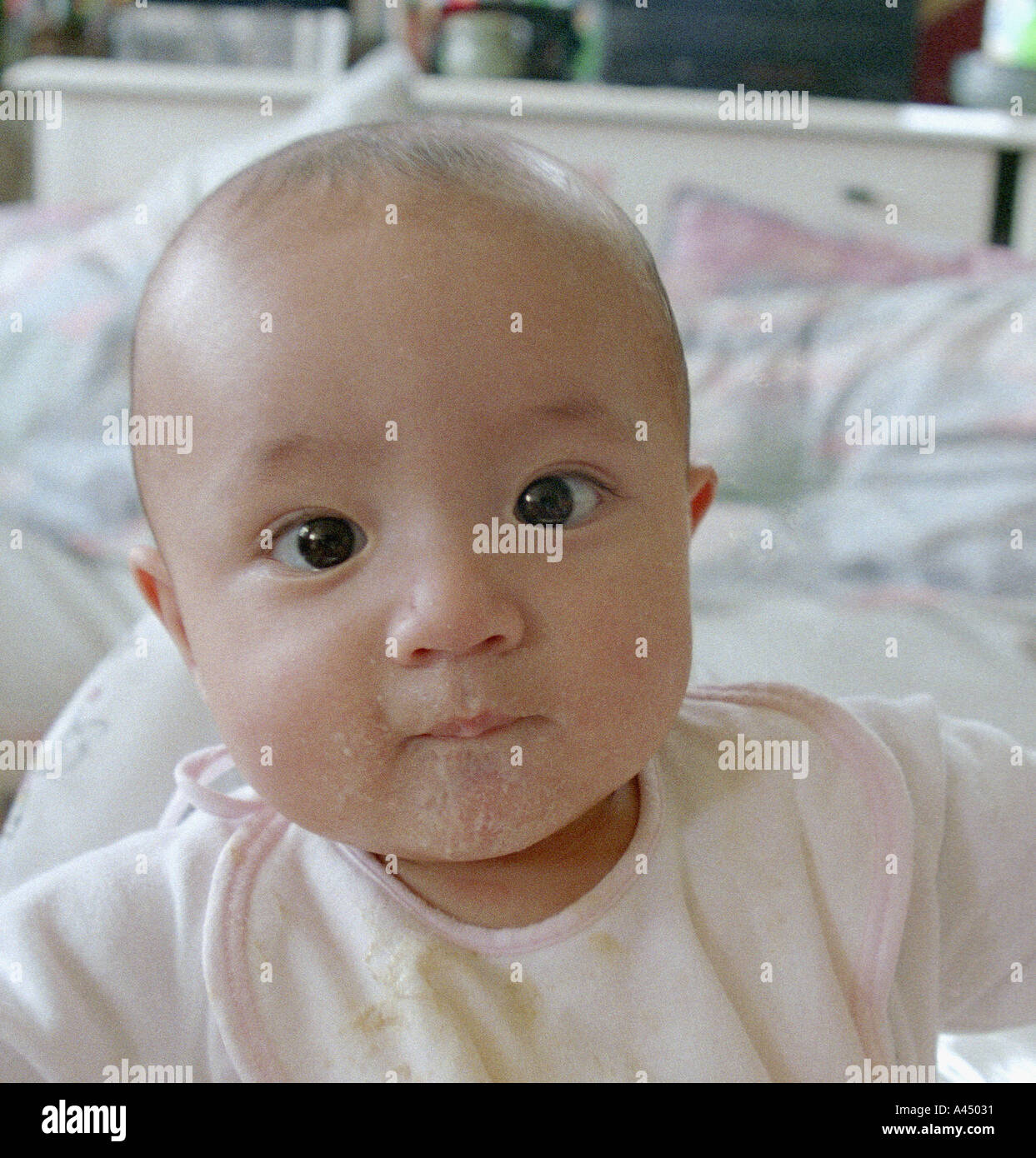 albino chinese baby