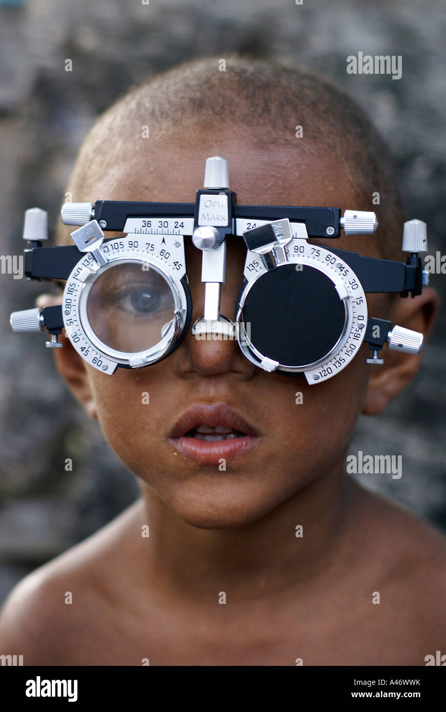Boy with an instrument for eye examinations in Imbiribeira slum (favela), Recife, Brazil Stock Photo