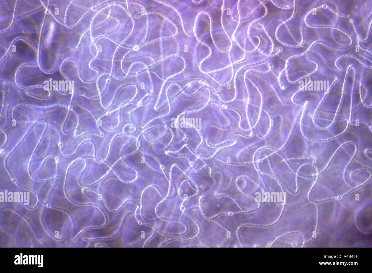 Photomicrograph of nostoc form of blue green algae Stock Photo Alamy