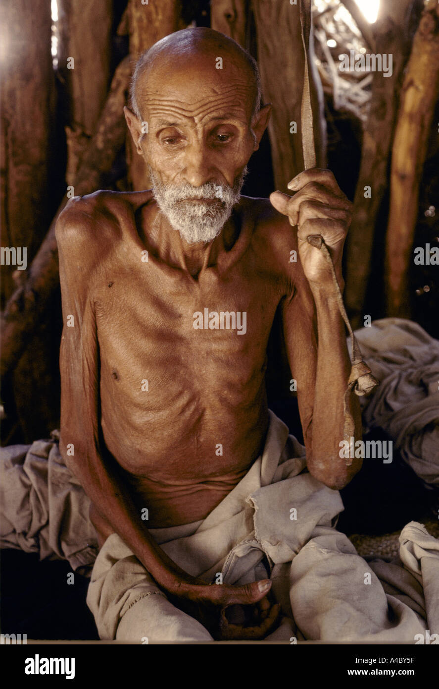 man hanging suffering from severe malnutrition Eritrea, Africa. Stock Photo
