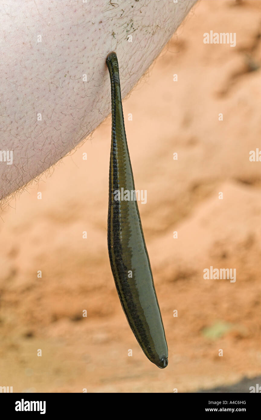 Medicinal Leech (Hirudo medicinalis) feeding on human leg Stock Photo