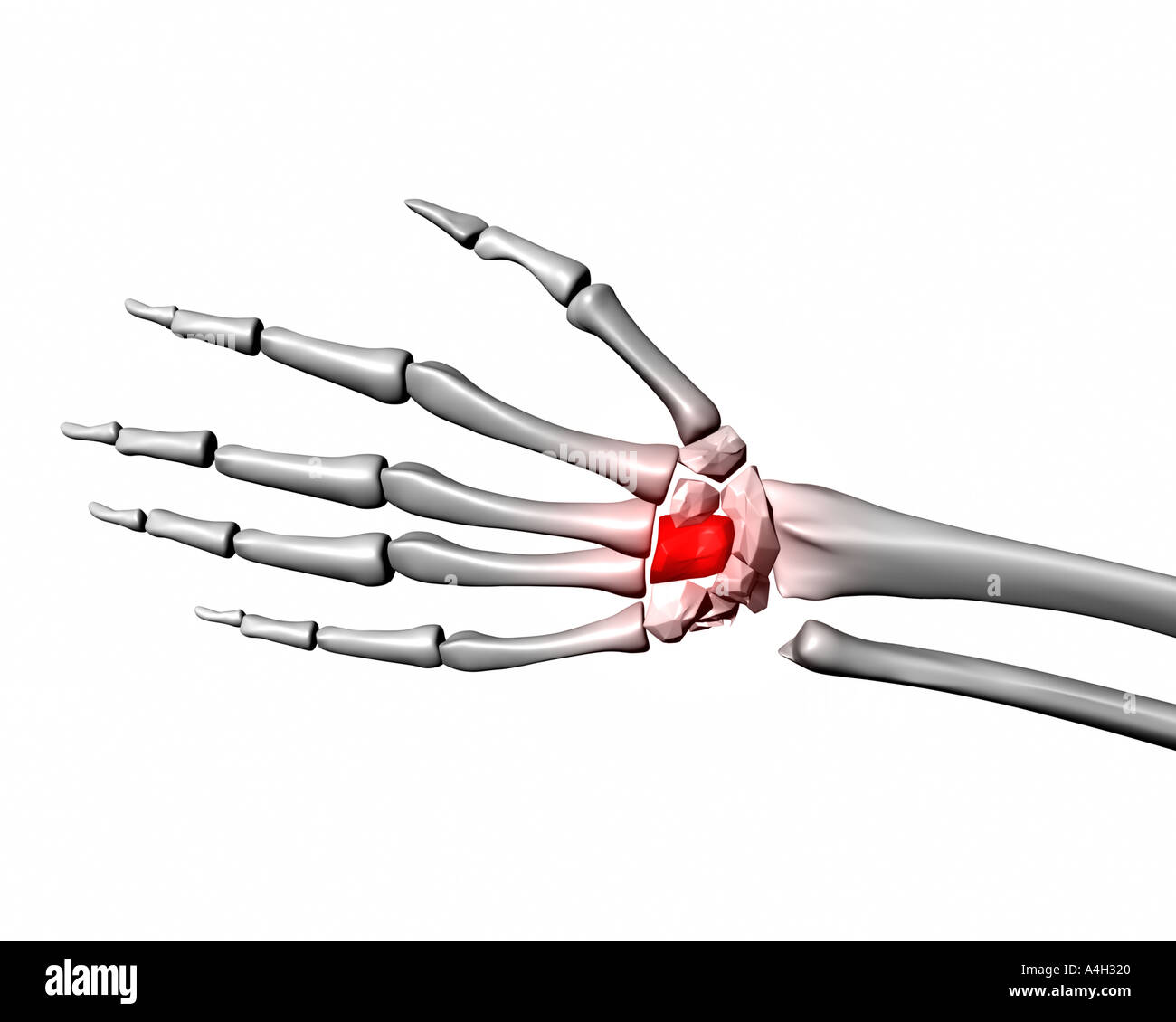 capitate highlighted red on human skeleton hand Stock Photo - Alamy
