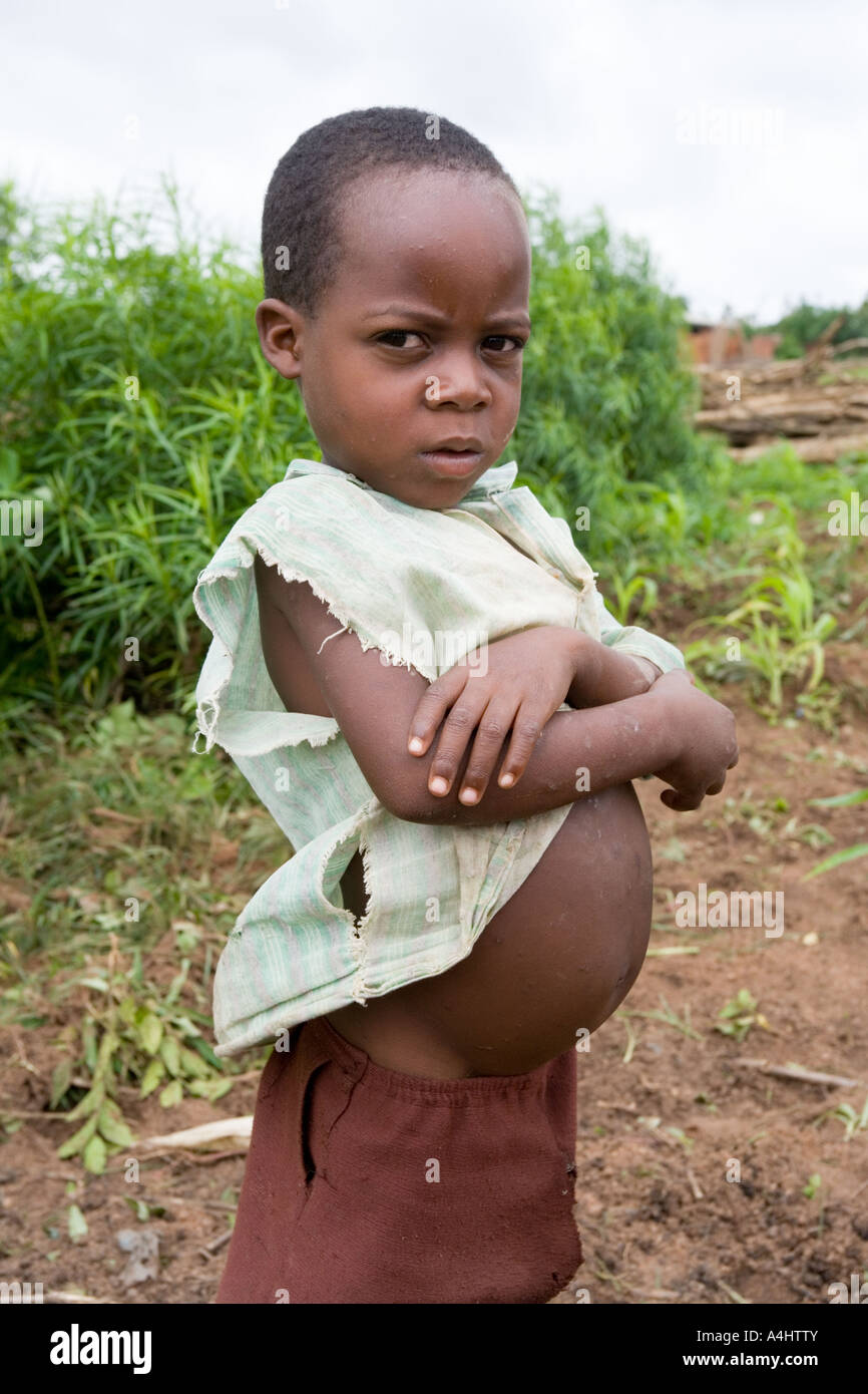 Hungry boy in the village of Buli, Malawi, Africa Stock Photo
