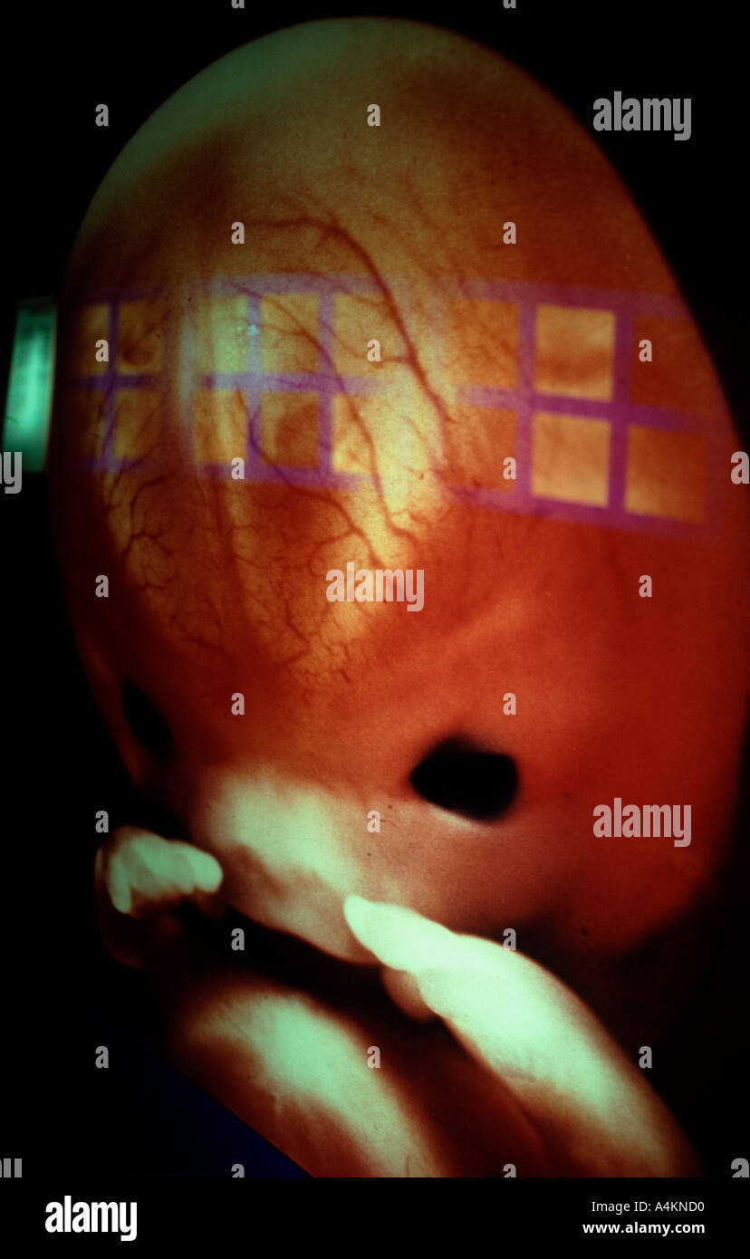 Human foetus image in Domus Museum A Coruña Spain Stock Photo