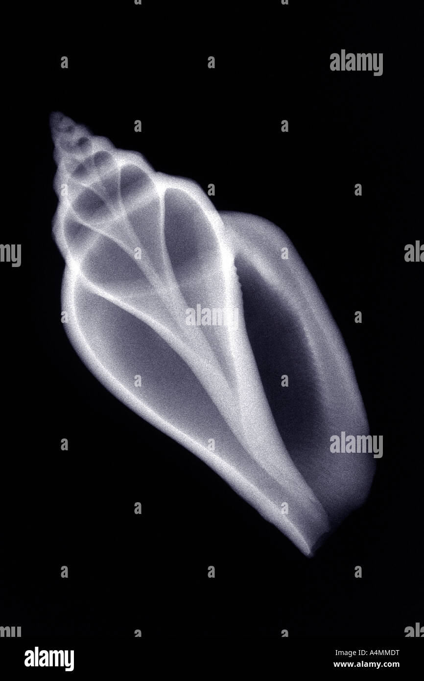 X-ray radiograph of a marine shell. Black and white picture. Radiographie d'un coquillage marin. Image noir et blanc. Stock Photo