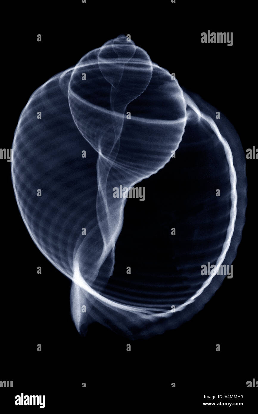 X-ray photograph of a banded tun (Tonna sulcosa). Black and white ...
