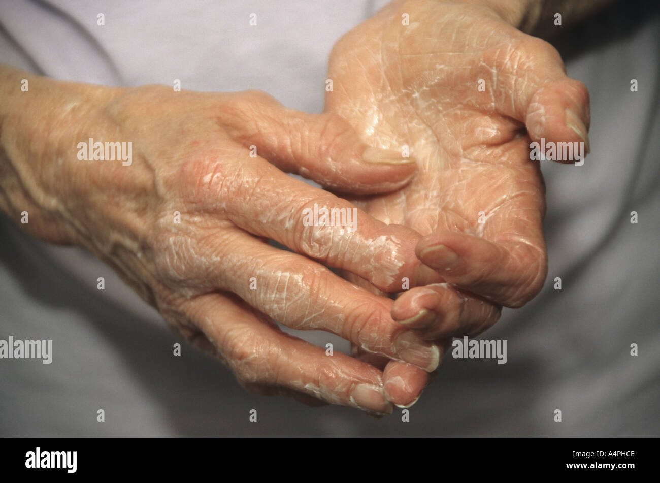 HAND CREAM FOR ARTHRITIC HANDS intelligence overview