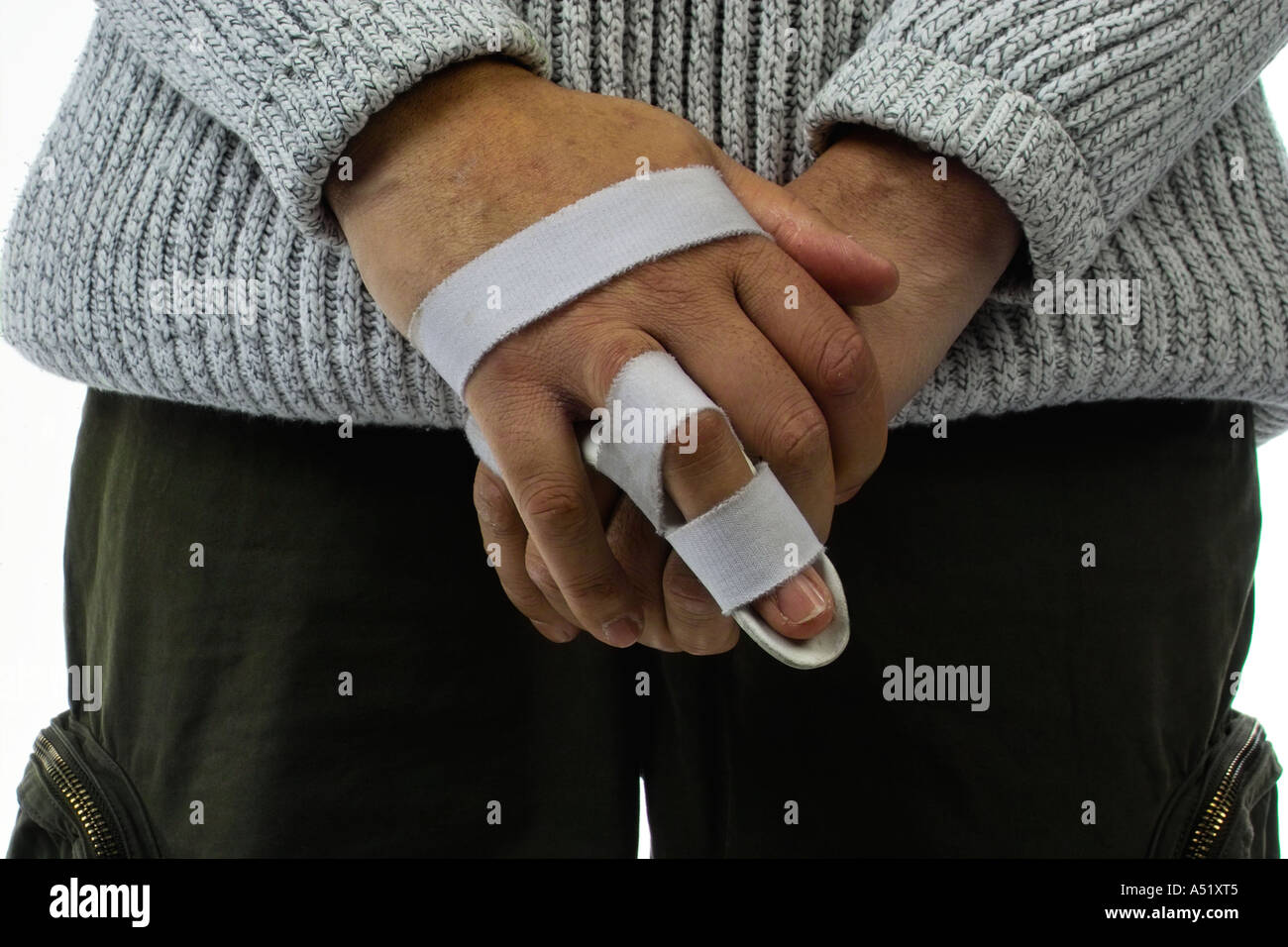 Man with a snapped tendon Stock Photo