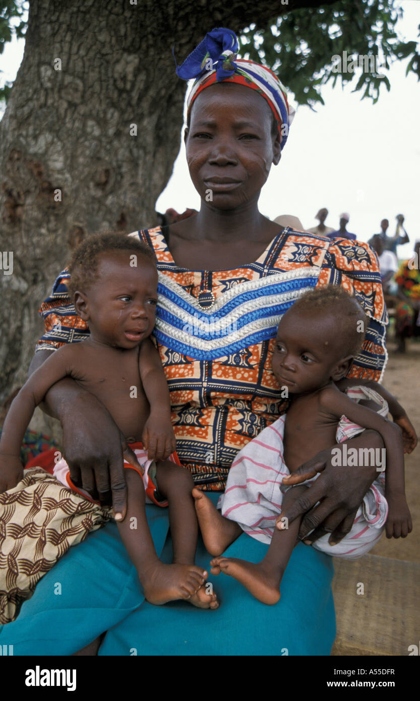 Painet ik0310 7222 ghana mother malnourished children bongo bolgatanga country developing nation less economically developed Stock Photo
