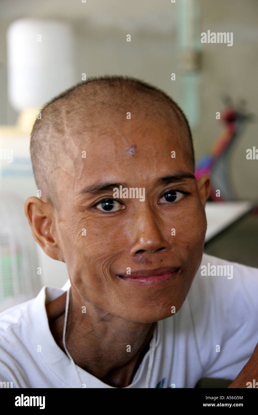 Painet iy8510 thailand hiv patients aids hospice buddhist temple ...