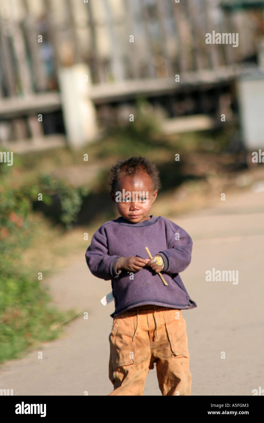 Young Boy in Antananarivo, Madagascar Stock Photo