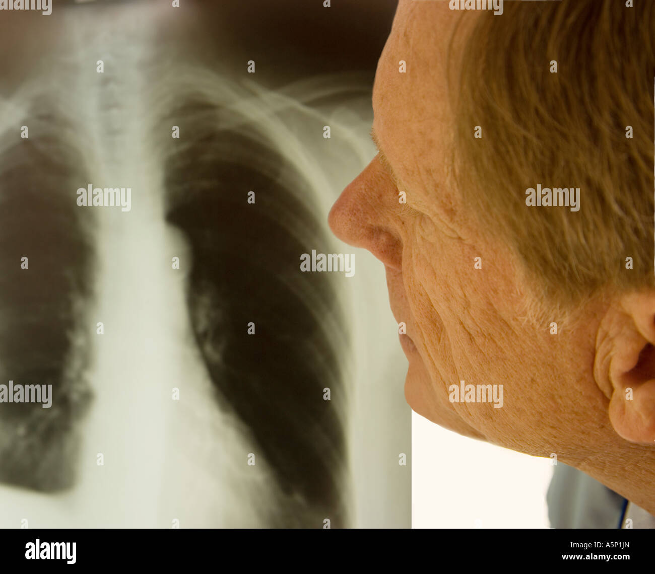 Doctor reviews chest xray Stock Photo Alamy