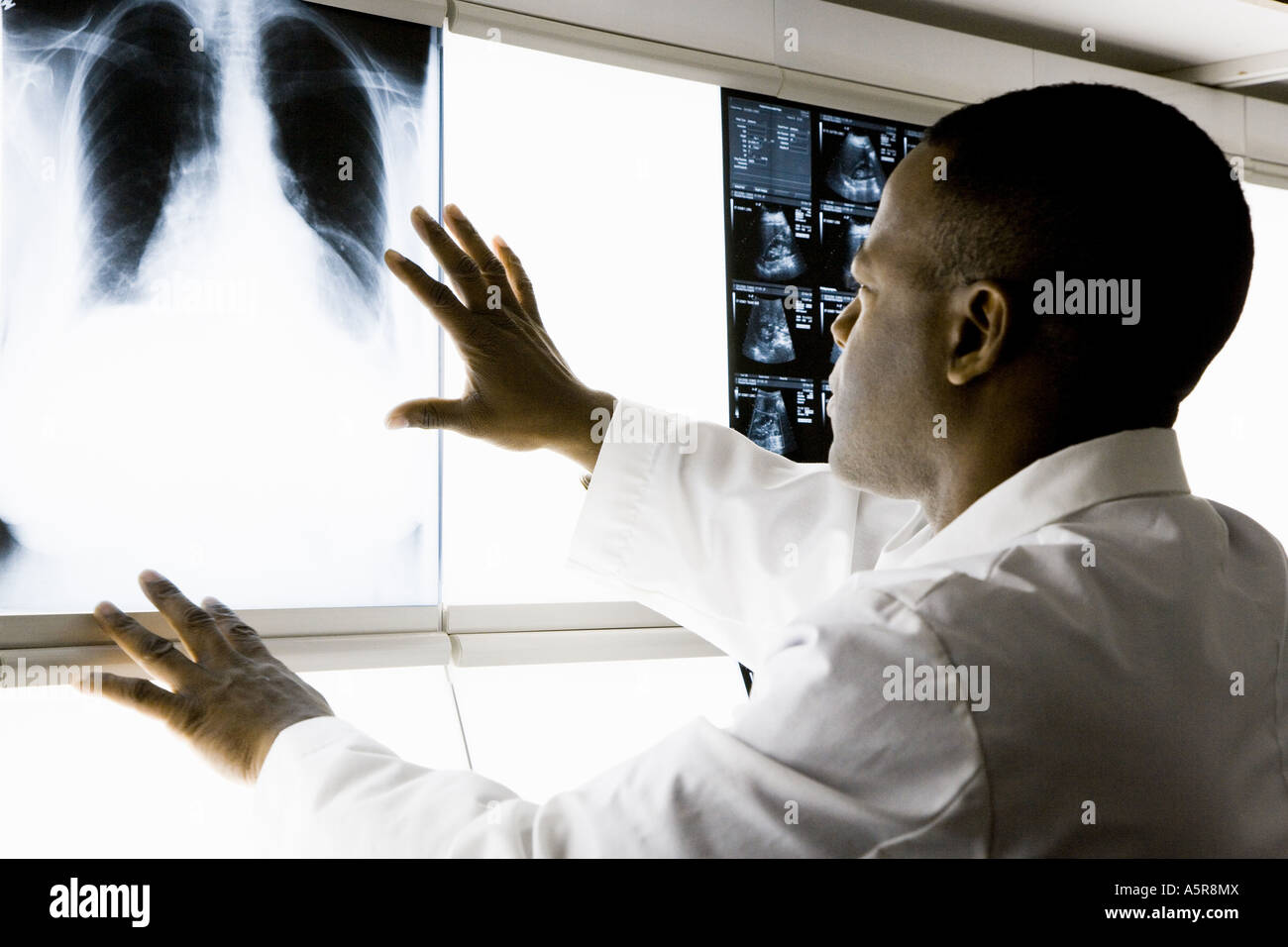 Male doctor looking at chest x rays Stock Photo - Alamy