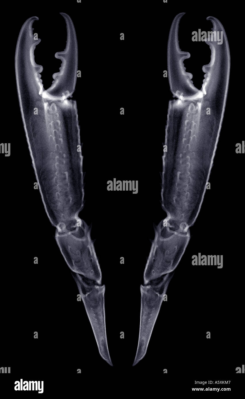 X-ray photograph of a langoustine's pair of claws (Nephrops norvegicus). Radiographie de pinces de langoustine. Stock Photo
