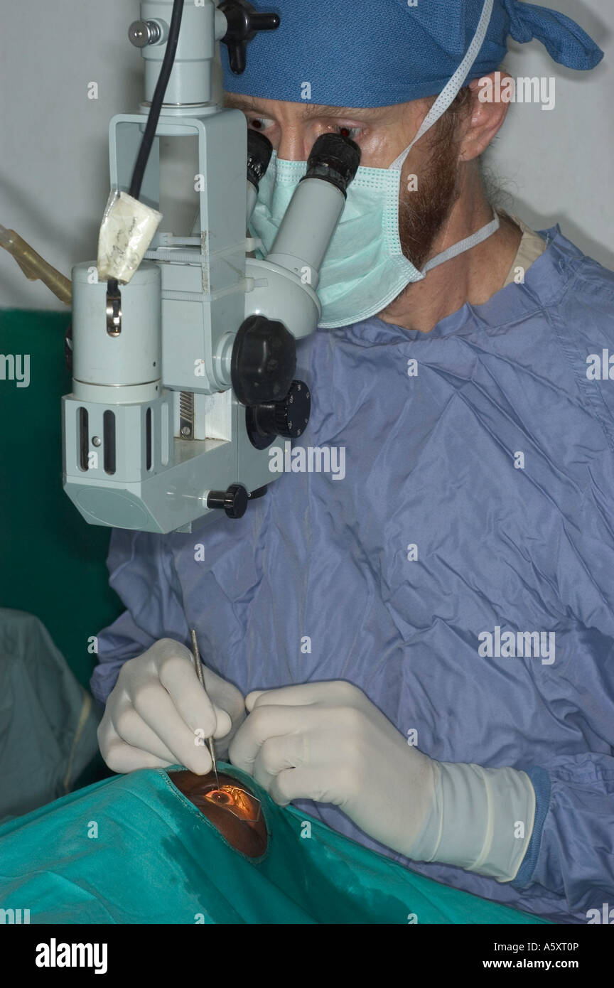 surgeon performing cataract surgery on a patient in Nigeria Stock Photo