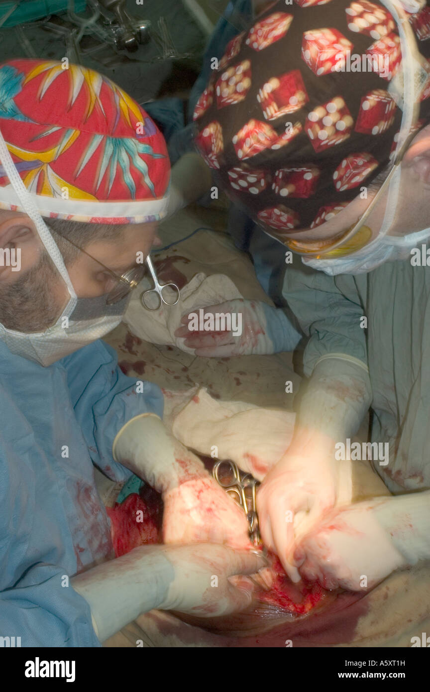 Volunteer surgeons in Nigeria wearing face mask cap gloves and gown to prevent the spread of infections during surgery Stock Photo