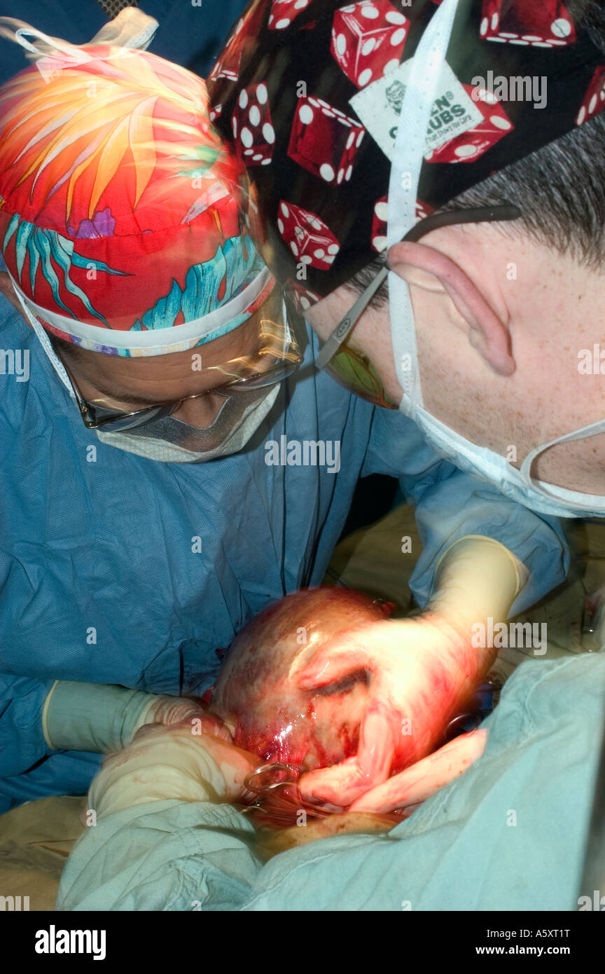 Volunteer surgeons in Nigeria wearing face mask cap gloves and gown to prevent the spread of infections during surgery Stock Photo