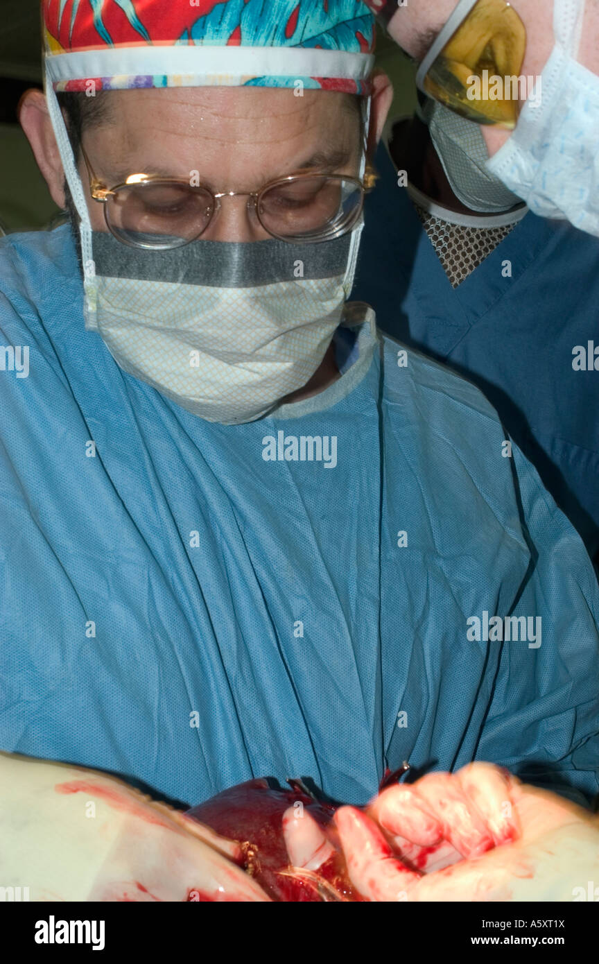 Volunteer surgeons in Nigeria wearing face mask cap gloves and gown to prevent the spread of infections during surgery Stock Photo