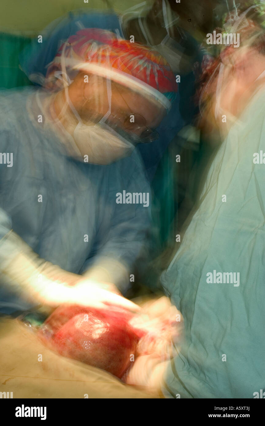 Action shot of volunteer surgeons in Nigeria wearing face mask cap gloves and gown to prevent the spread of infections during su Stock Photo