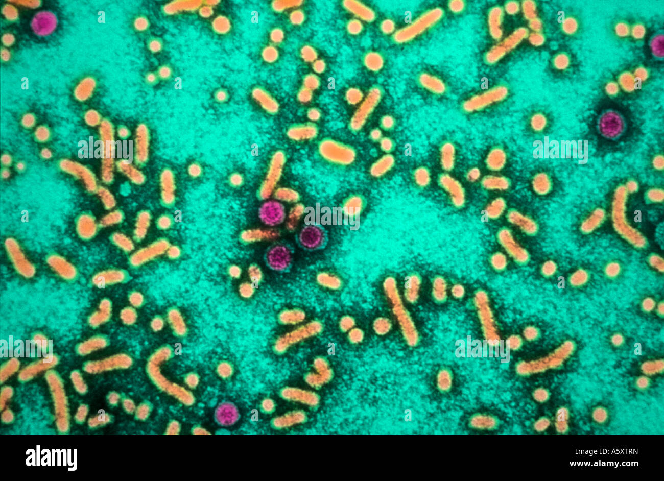Transmission electron microscope negative stained image of hepa Stock Photo