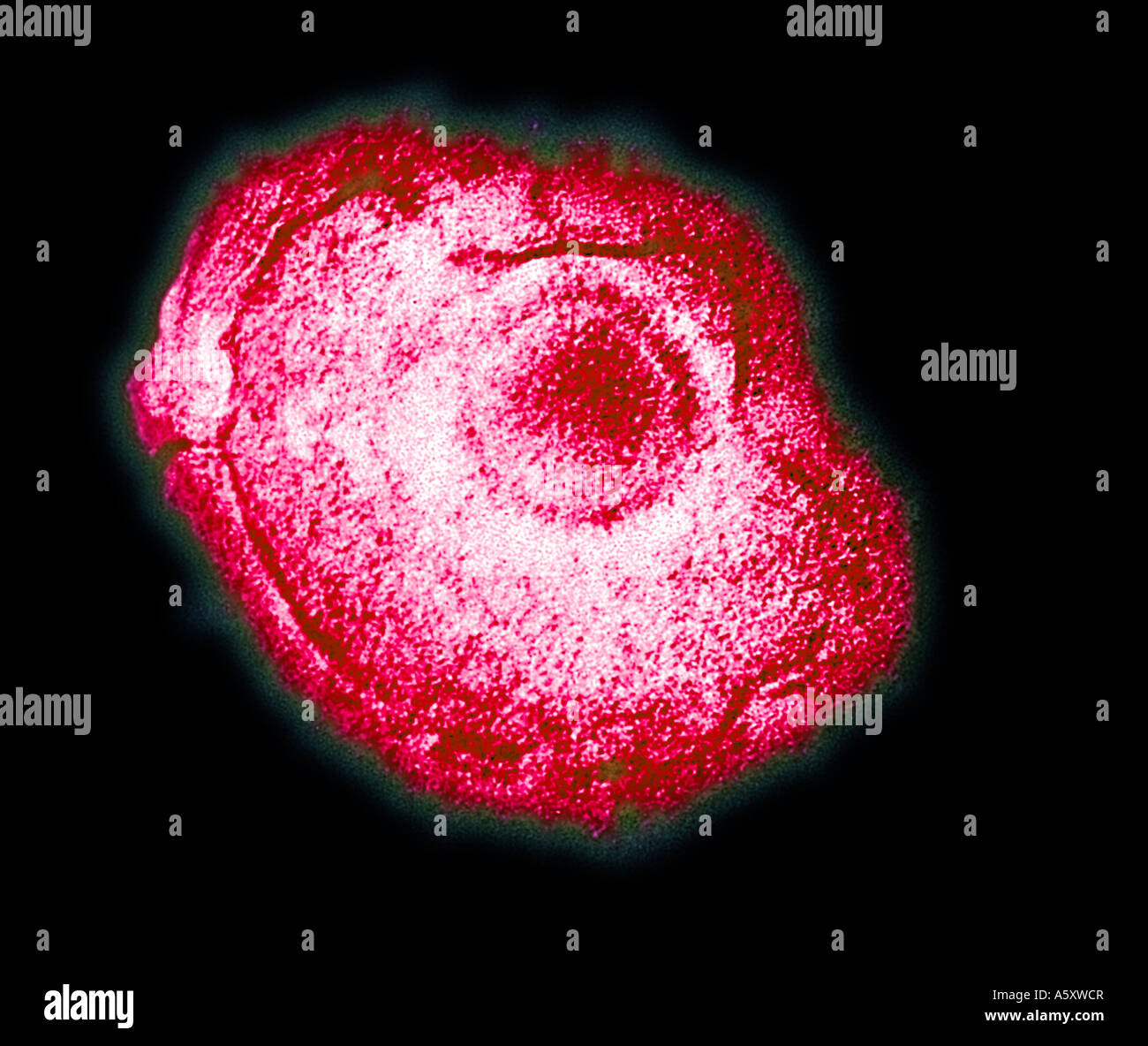 Varicella Virus Electronmicrograph Chickenpox Stock Photo Alamy