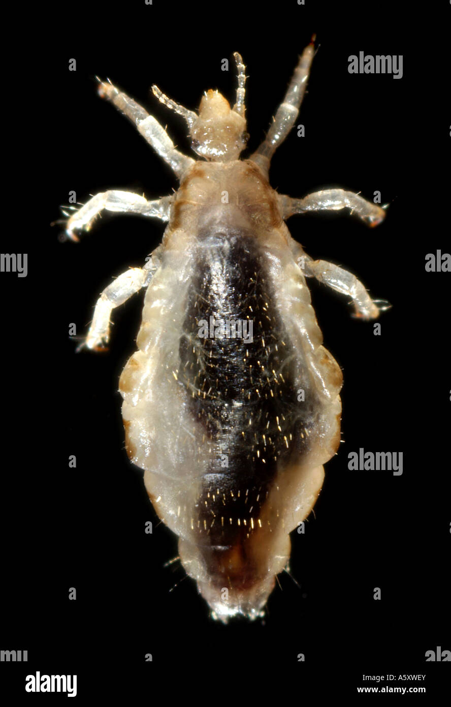 dorsal view of a female body louse Pediculus humanus var corporis Stock  Photo - Alamy