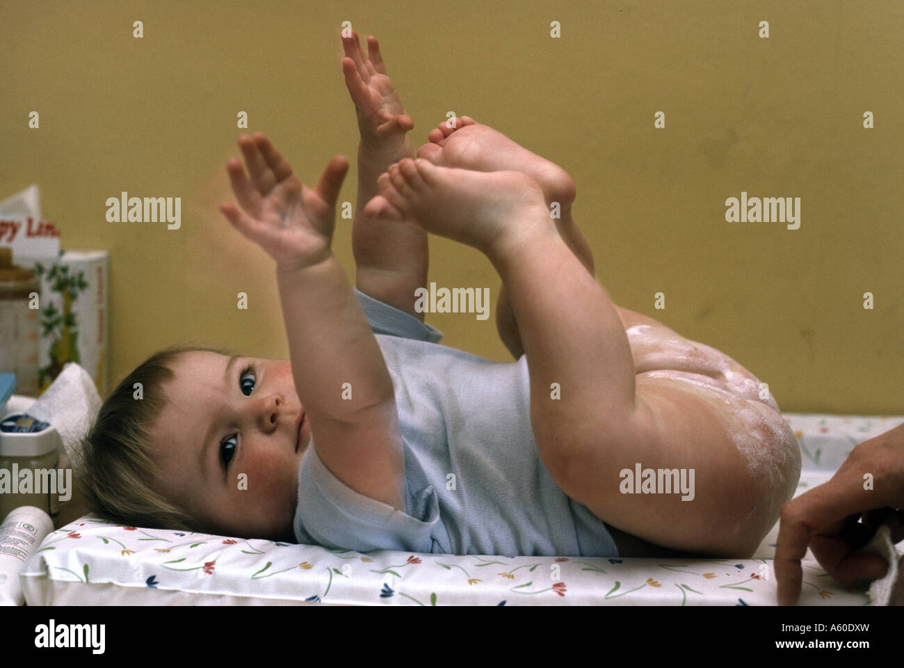 baby rash ointment applied to child's bottom Stock Photo