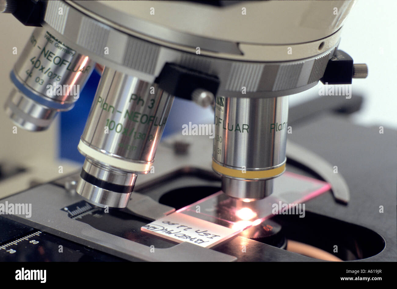 Tissue slices under the microscope for the analysis of cancer cells Stock Photo