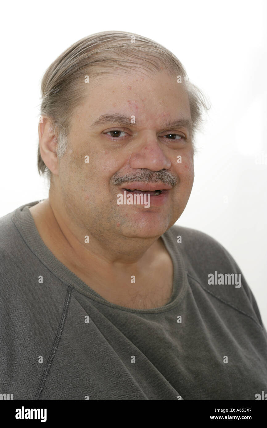 Overweight man smiles. Stock Photo