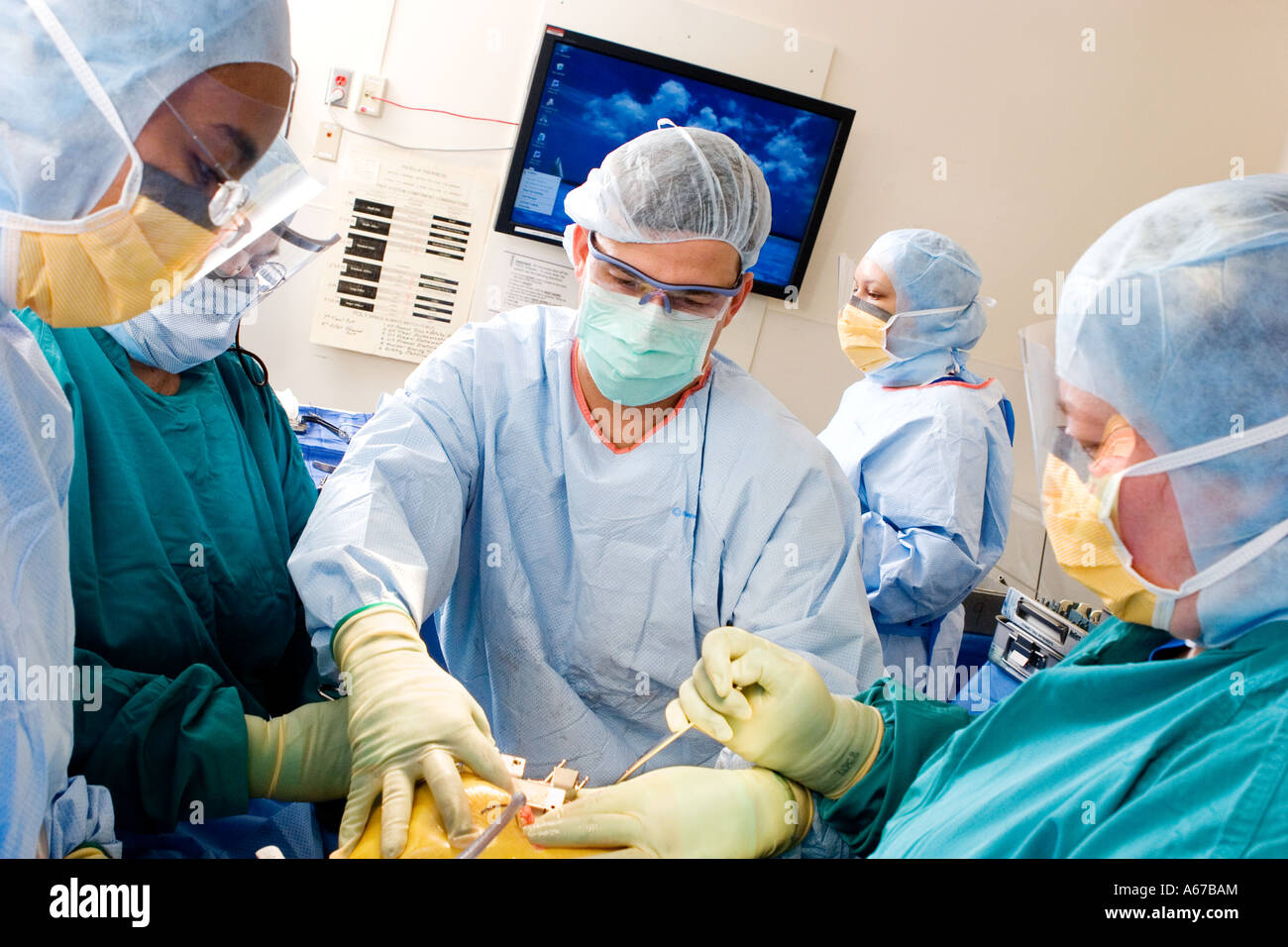 orthopedic surgeon performing a knee joint replacement procedure Stock