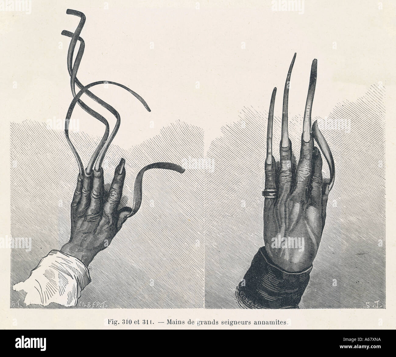 Overgrown Fingernails Stock Photo: 6565593 - Alamy