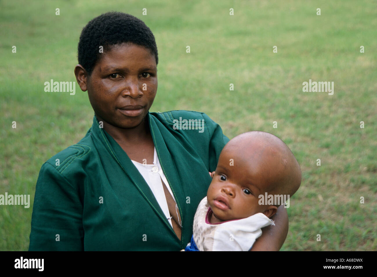 Mother with her child who suffers from Hydrocephalus, Moshi, Tanzania Stock Photo