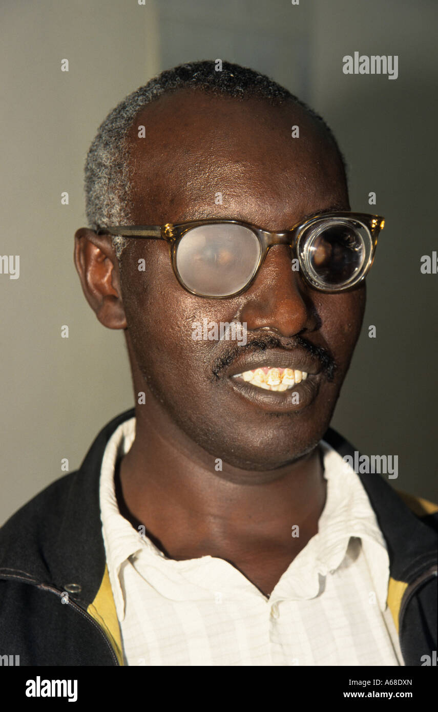 Man with very low eye vision wearing special glasses, Kikuyu, Kenya Stock Photo