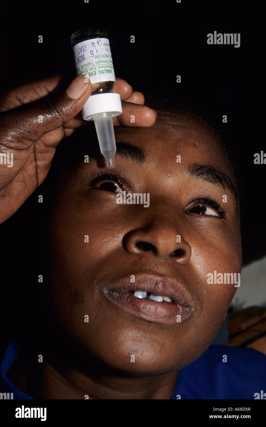 Applying eye drops, Kikuyu Eye Unit, Kenya Stock Photo