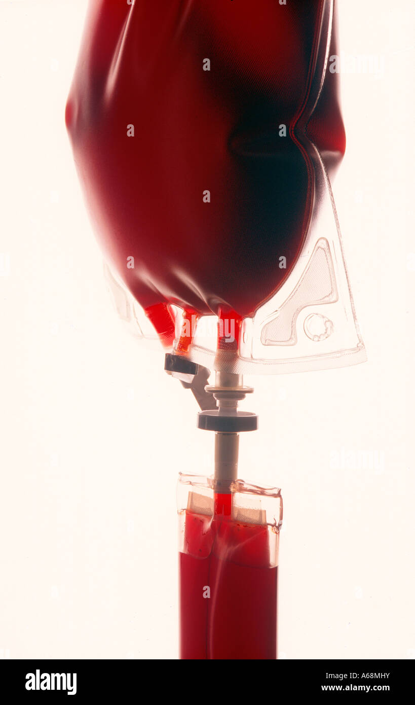 Blood hanging from an IV Stock Photo