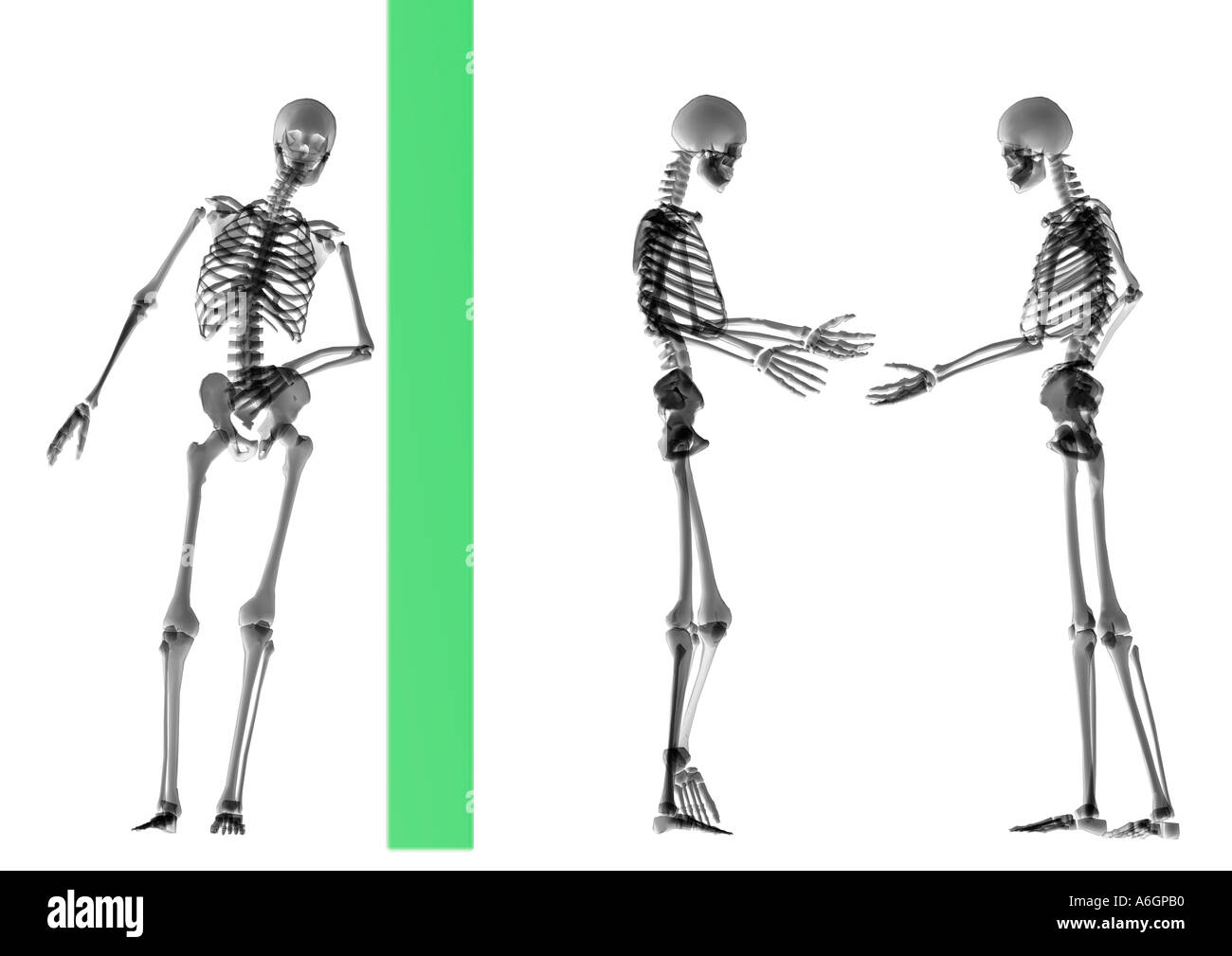 x ray skeleton spy Stock Photo