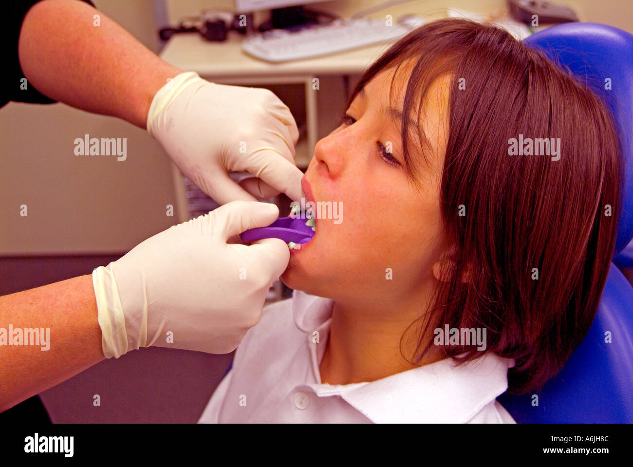 Young boy having dental moulds made in orthodontist s surgery Stock