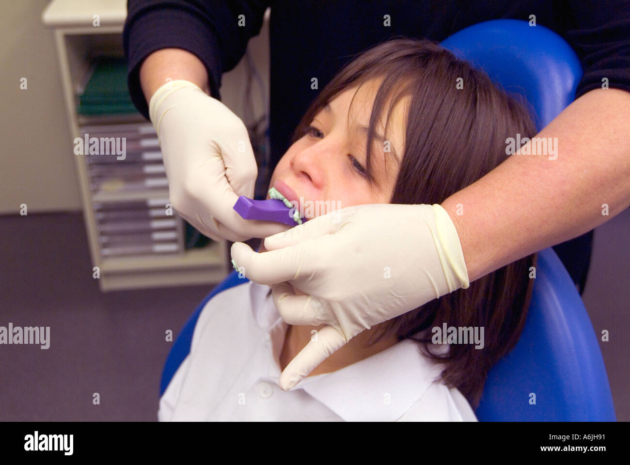 Young boy having dental moulds made prior to getting braces Stock Photo