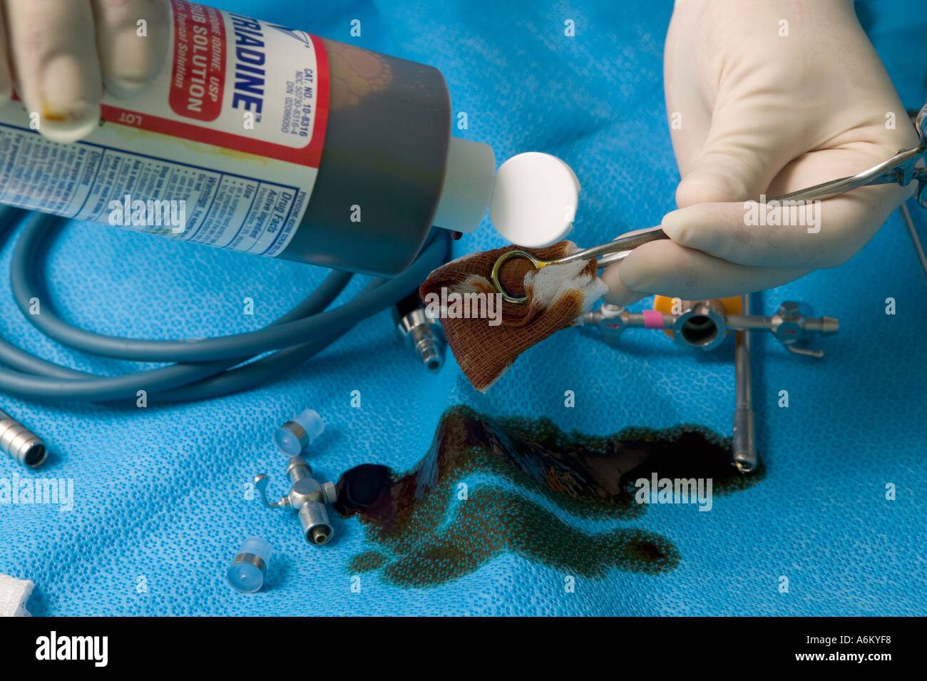 Pouring antiseptic betadine solution during surgery Stock Photo