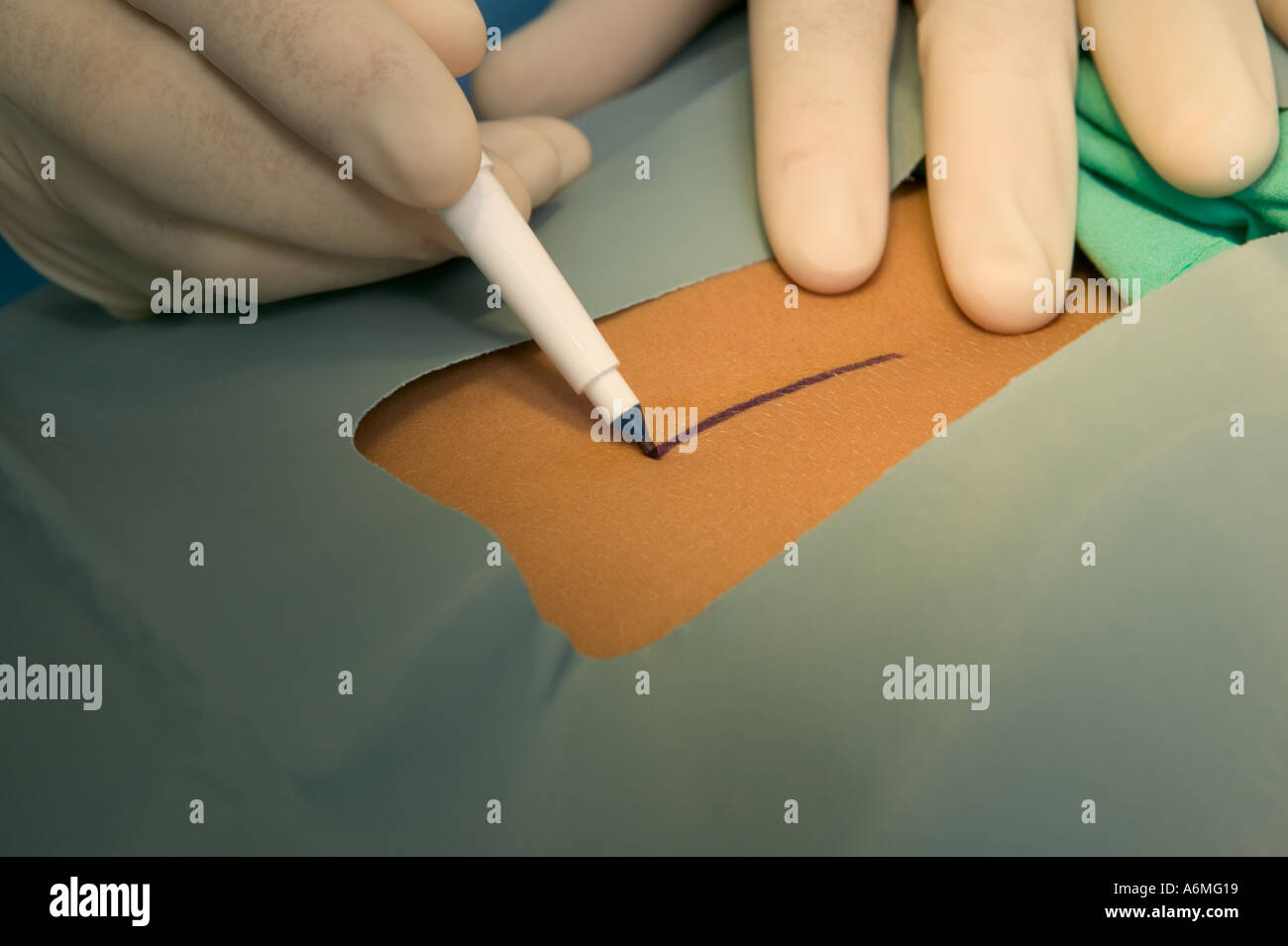 Surgery Incision Instruments Medical Stock Photos & Surgery Incision