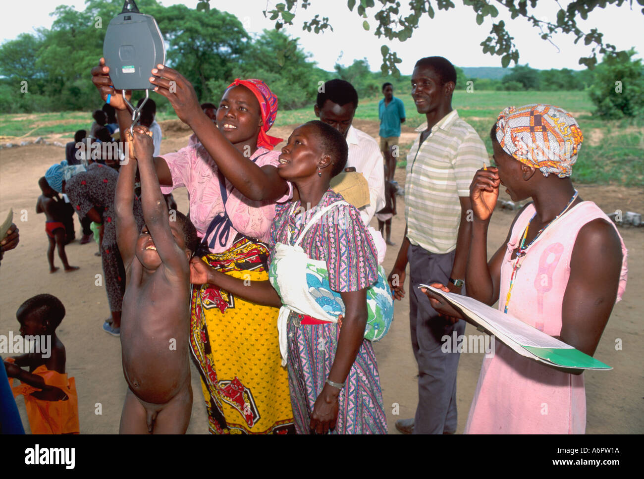 Health workers weighing a child at an open-air rural health clinic. Zimbabwe Stock Photo