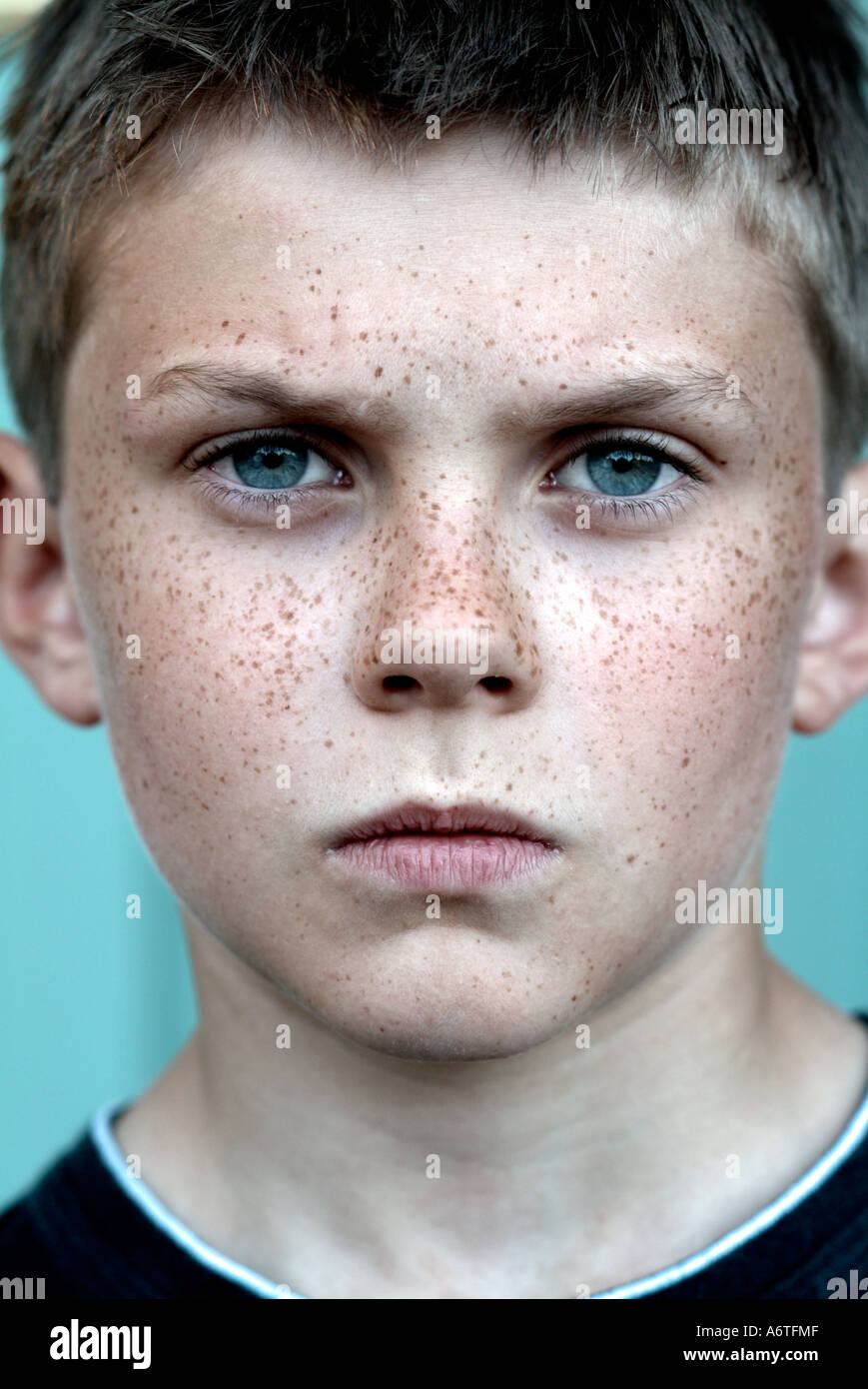 Portrait of a freckly boy with a serious expression on his face Stock Photo