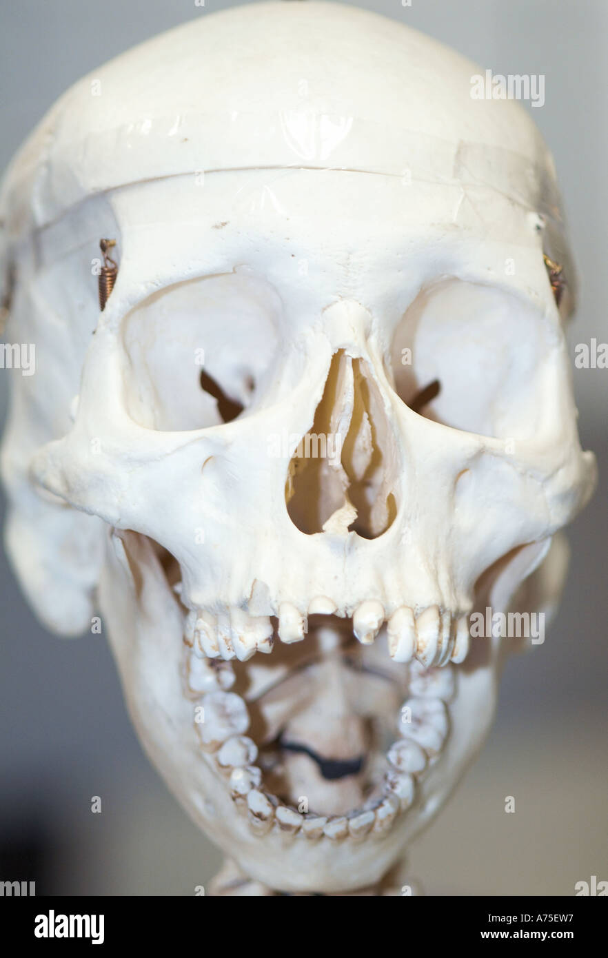 Face Facial Maxillofacial Surgery Surgeon Operation Fracture