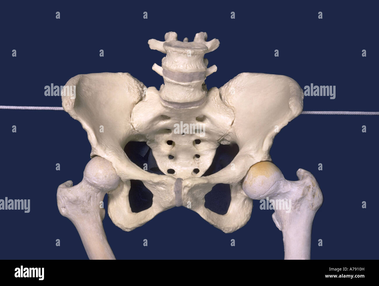 A pelvic model showing fixed abduction of the hip. Stock Photo