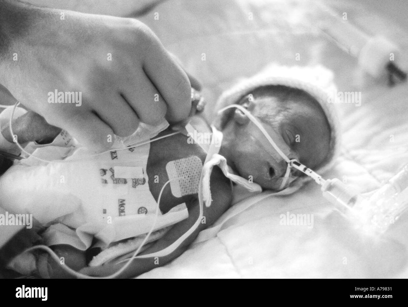 Premature baby Stock Photo