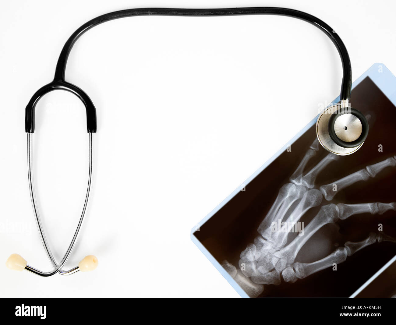 An x-ray of a hand with a stethoscope isolated on white Stock Photo