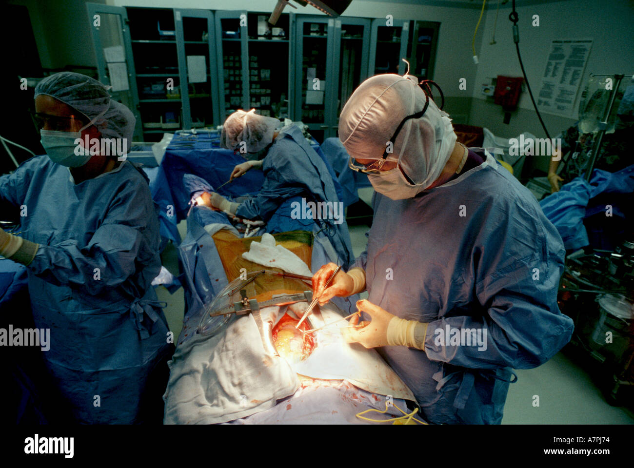 Open heart surgery hires stock photography and images Alamy